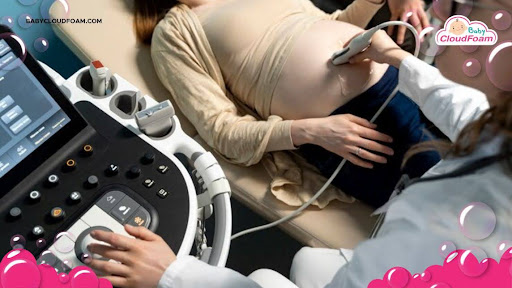 Penyebab posisi bayi melintang