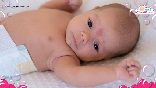 Bintik putih pada bayi