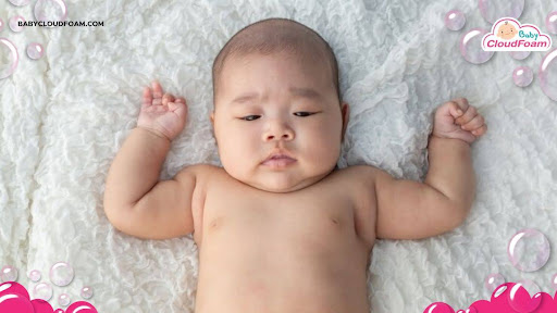 Bintik putih pada bayi