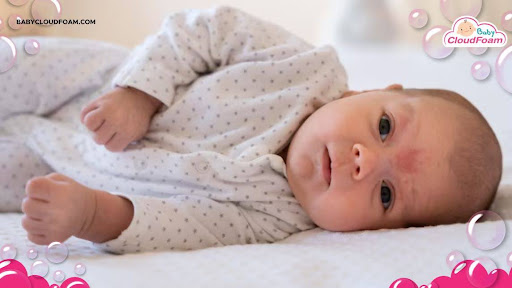 Bintik putih pada bayi