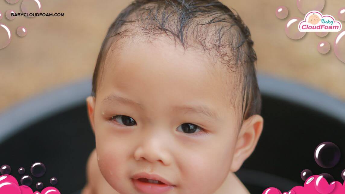 ubun ubun bayi menonjol