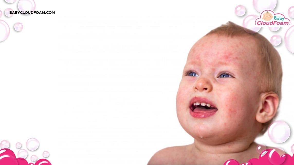 Sawan bayi tidak mau menyusu